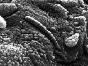 Бактерии в марсианском метеорите